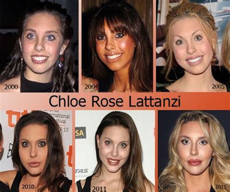 chloe rose lattanzi net worth|chloe lattanzi before and after.